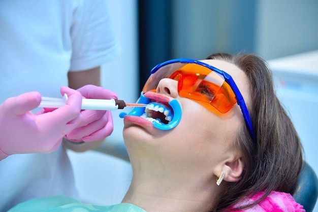 Clinic whitening treatment